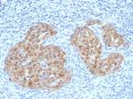 P16INK4a Antibody in Immunohistochemistry (Paraffin) (IHC (P))