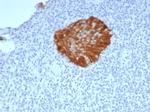 P16INK4a Antibody in Immunohistochemistry (Paraffin) (IHC (P))