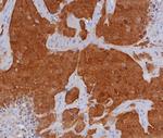 P16INK4a Antibody in Immunohistochemistry (Paraffin) (IHC (P))