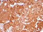 P16INK4a Antibody in Immunohistochemistry (Paraffin) (IHC (P))