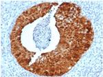 P16INK4a Antibody in Immunohistochemistry (Paraffin) (IHC (P))