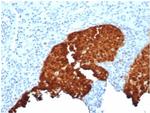 P16INK4a Antibody in Immunohistochemistry (Paraffin) (IHC (P))