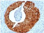 P16INK4a Antibody in Immunohistochemistry (Paraffin) (IHC (P))