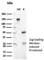 P16INK4a Antibody in SDS-PAGE (SDS-PAGE)