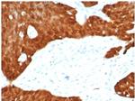 P16INK4a Antibody in Immunohistochemistry (Paraffin) (IHC (P))