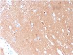 Tubulin beta 3/TUBB3 Antibody in Immunohistochemistry (Paraffin) (IHC (P))