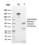 Tubulin beta 3/TUBB3 Antibody in SDS-PAGE (SDS-PAGE)