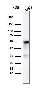 Tubulin beta 3/TUBB3 Antibody in Western Blot (WB)