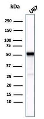 Tubulin beta 3/TUBB3 Antibody in Western Blot (WB)