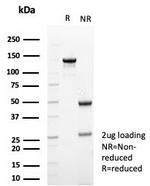 Tubulin beta 3/TUBB3 (Neuronal and Stem Cell Marker) Antibody in SDS-PAGE (SDS-PAGE)