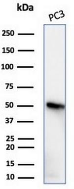 Tubulin beta 3/TUBB3 (Neuronal and Stem Cell Marker) Antibody in Western Blot (WB)