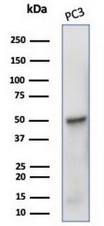 Tubulin beta 3/TUBB3 (Neuronal and Stem Cell Marker) Antibody in Western Blot (WB)