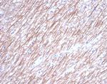 Tubulin beta 3/TUBB3 (Neuronal and Stem Cell Marker) Antibody in Immunohistochemistry (Paraffin) (IHC (P))