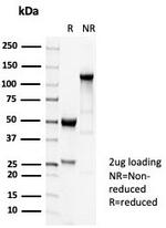 Tubulin beta 3/TUBB3 (Neuronal and Stem Cell Marker) Antibody in SDS-PAGE (SDS-PAGE)