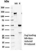 Tubulin beta 3/TUBB3 (Neuronal and Stem Cell Marker) Antibody in SDS-PAGE (SDS-PAGE)