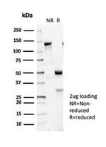 Tubulin beta 3/TUBB3 (Neuronal and Stem Cell Marker) Antibody in Immunoelectrophoresis (IE)