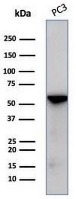 Tubulin beta 3/TUBB3 (Neuronal and Stem Cell Marker) Antibody in Western Blot (WB)