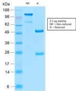 CD52 (Epididymis-Specific Protein 5) Antibody in Immunohistochemistry (Paraffin) (IHC (P))