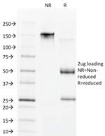 CDX1/Caudal Type Homeobox 1 (Intestine-Specific Transcription Factor) Antibody in SDS-PAGE (SDS-PAGE)