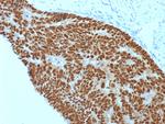 CDX2/Caudal Type Homeobox 2 (GI Epithelial Marker) Antibody in Immunohistochemistry (Paraffin) (IHC (P))