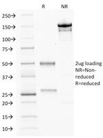 CDX2/Caudal Type Homeobox 2 (GI Epithelial Marker) Antibody in SDS-PAGE (SDS-PAGE)