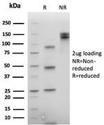 CDX2/Caudal Type Homeobox 2 (GI Epithelial Marker) Antibody in SDS-PAGE (SDS-PAGE)