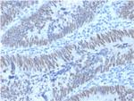 CDX2/Caudal Type Homeobox 2 (GI Epithelial Marker) Antibody in Immunohistochemistry (Paraffin) (IHC (P))