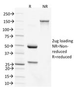 CDX2/Caudal Type Homeobox 2 (GI Epithelial Marker) Antibody in SDS-PAGE (SDS-PAGE)