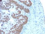 CDX2/Caudal Type Homeobox 2 (GI Epithelial Marker) Antibody in Immunohistochemistry (Paraffin) (IHC (P))