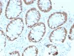 CDX2/Caudal Type Homeobox 2 Antibody in Immunohistochemistry (Paraffin) (IHC (P))