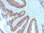 CDX2/Caudal Type Homeobox 2 Antibody in Immunohistochemistry (Paraffin) (IHC (P))