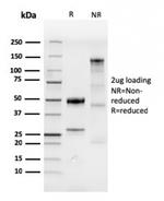 CDX2/Caudal Type Homeobox 2 Antibody in SDS-PAGE (SDS-PAGE)