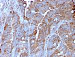 MerTK (Innate Immune Checkpoint) Antibody in Immunohistochemistry (Paraffin) (IHC (P))