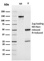 MerTK (Innate Immune Checkpoint) Antibody in SDS-PAGE (SDS-PAGE)