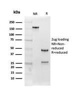 Follistatin/Activin Binding Protein Antibody in SDS-PAGE (SDS-PAGE)