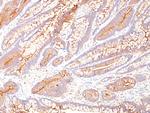 Carcinoembryonic Antigen (CEA)/CD66 Antibody in Immunohistochemistry (Paraffin) (IHC (P))