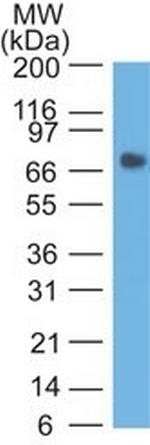 Carcinoembryonic Antigen (CEA)/CD66 Antibody in Western Blot (WB)