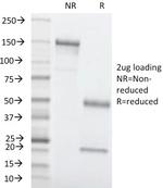 Carcinoembryonic Antigen (CEA)/CD66 Antibody in SDS-PAGE (SDS-PAGE)