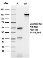 Carcinoembryonic Antigen (CEA)/CD66 Antibody in SDS-PAGE (SDS-PAGE)