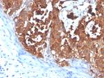 Carcinoembryonic Antigen (CEA)/CD66e Antibody in Immunohistochemistry (Paraffin) (IHC (P))