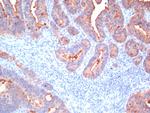 Carcinoembryonic Antigen, pan (CEA) Antibody in Immunohistochemistry (Paraffin) (IHC (P))