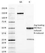 Carcinoembryonic Antigen, pan (CEA) Antibody in SDS-PAGE (SDS-PAGE)