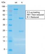 Carcinoembryonic Antigen (CEA)/CD66 Antibody in SDS-PAGE (SDS-PAGE)