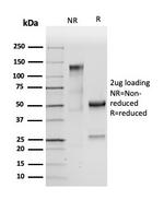 Carcinoembryonic Antigen (CEA)/CD66 Antibody in SDS-PAGE (SDS-PAGE)