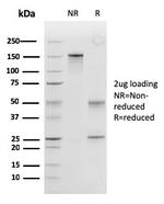 Peroxiredoxin 4 (Prognostic Marker for Lung SqCC) Antibody in SDS-PAGE (SDS-PAGE)