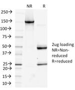 Podoplanin (PDPN) Antibody in SDS-PAGE (SDS-PAGE)