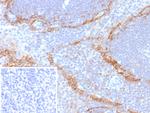 Podoplanin (PDPN) (Lymphatic Endothelial and Mesothelial Marker) Antibody in Immunohistochemistry (Paraffin) (IHC (P))