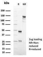 Podoplanin (PDPN) (Lymphatic Endothelial and Mesothelial Marker) Antibody in SDS-PAGE (SDS-PAGE)