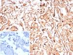 Podoplanin (PDPN) (Lymphatic Endothelial and Mesothelial Marker) Antibody in Immunohistochemistry (Paraffin) (IHC (P))