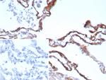 Periostin (POSTN) Antibody in Immunohistochemistry (Paraffin) (IHC (P))